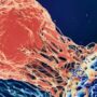 Studie forbinder mRNA-vaccine til cancer-overdødelighed i Japan